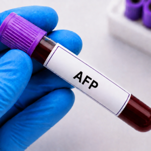AFP