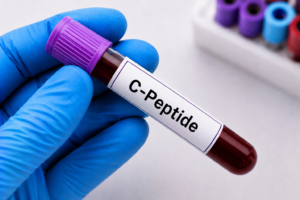 C-Peptide