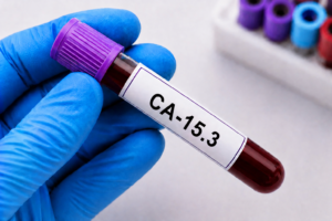 CA-15.3