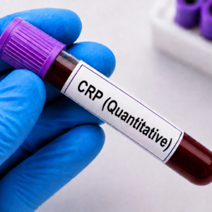 CRP (Quantitative)