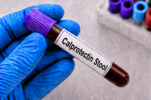Calprotectin Stool