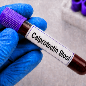 Calprotectin Stool