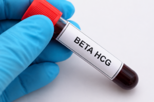 BETA HCG