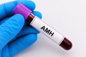 AMH