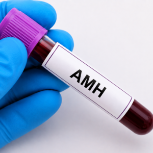 AMH