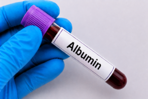 Albumin