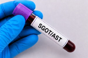 SGOT/AST