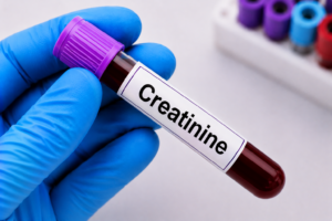 Creatinine