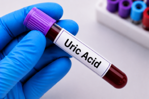 Uric Acid