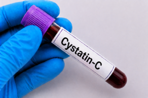 Cystatin-C