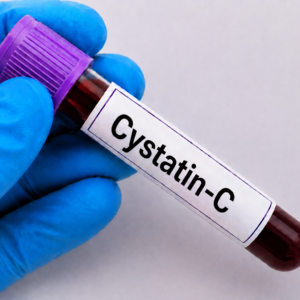 Cystatin-C