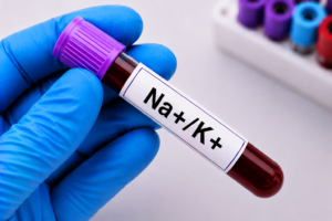 Na+/K+