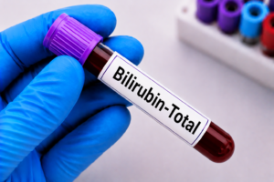 Bilirubin-Total