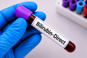 Bilirubin-Direct