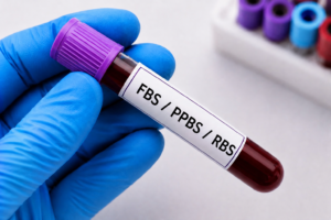 FBS / PPBS / RBS