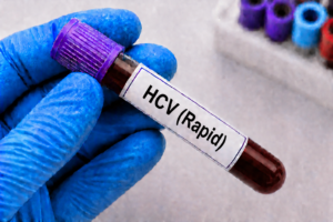 HCV (Rapid)