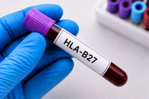 HLA-B27