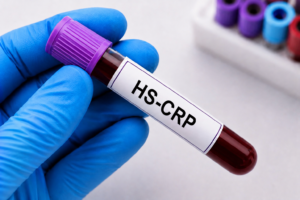 HS-CRP