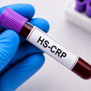 HS-CRP
