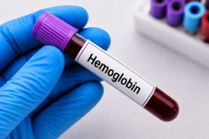 Hemoglobin