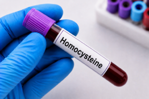 Homocysteine