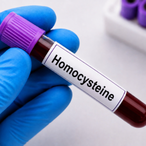 Homocysteine