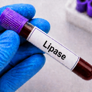 Lipase