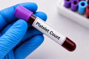 Platelet Count