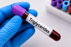 Triglycerides