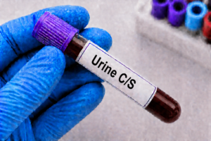 Urine C/S