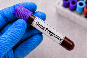 Urine Pregnancy