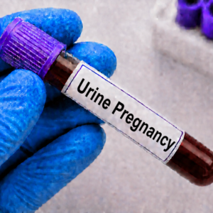 Urine Pregnancy